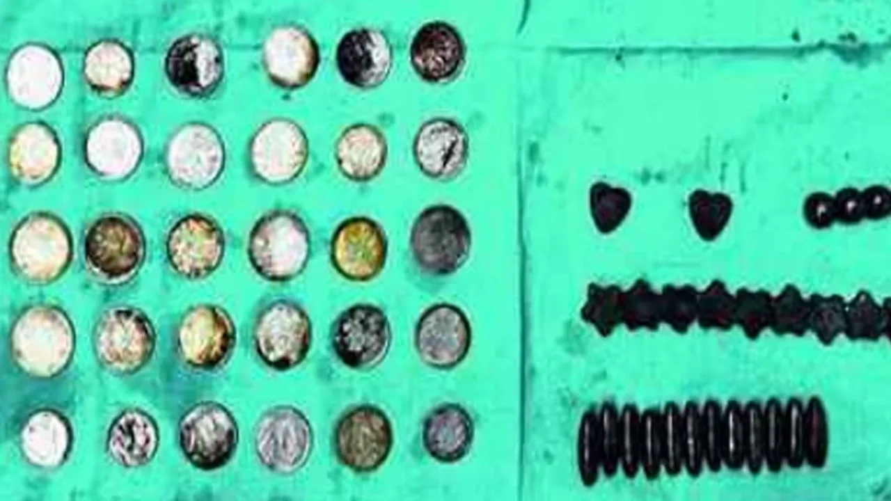 Doctors found 39 coins and 37 magnets