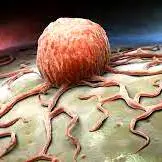 100 taka 'cancer-free'