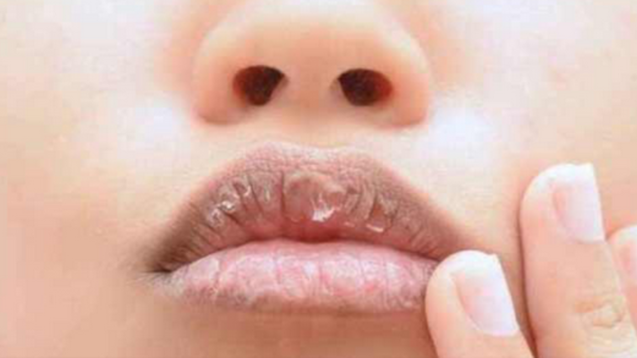 lip care in summer