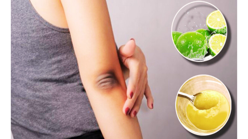 Skin Care Remove black spot