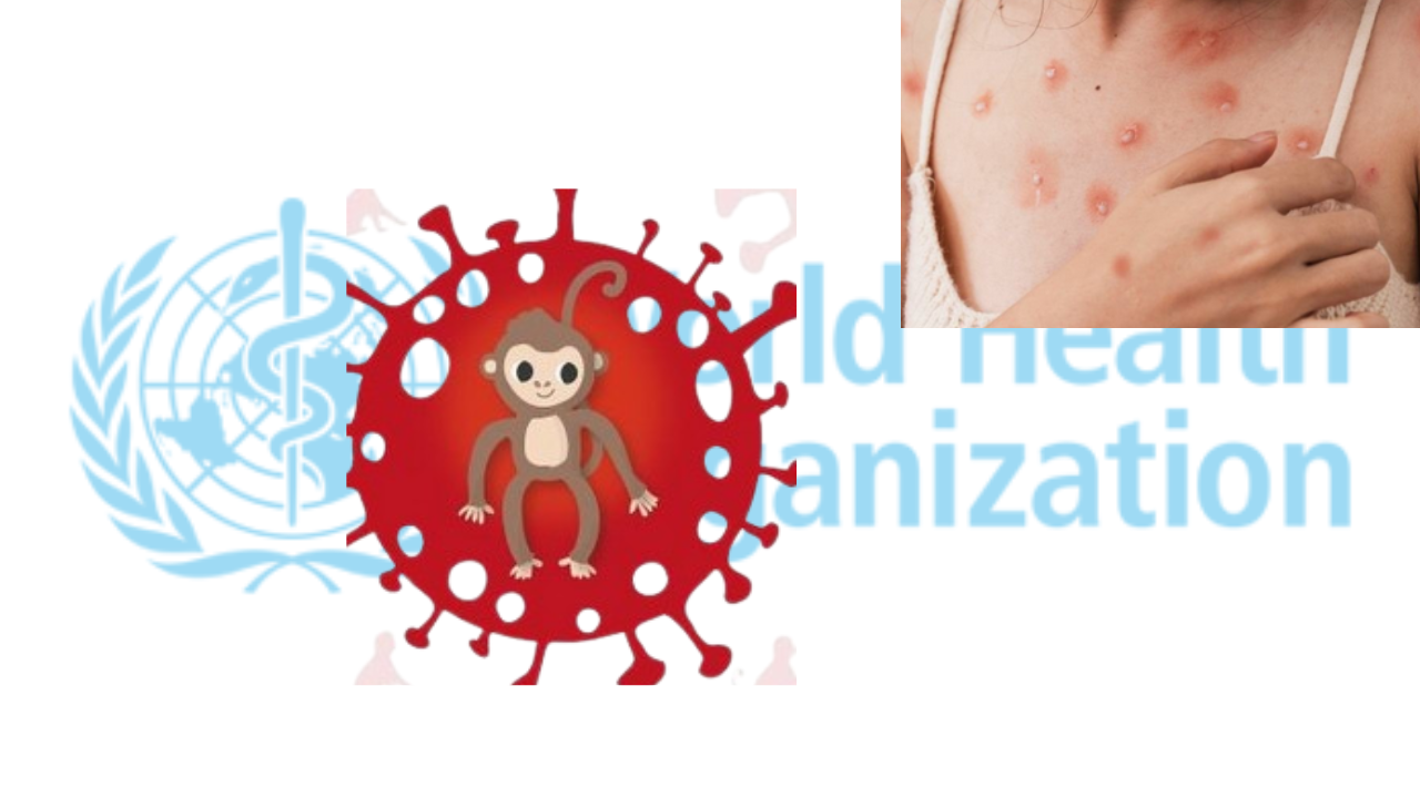 monkypox in india photo