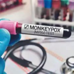 kerala-monkeypox-second-case-alert