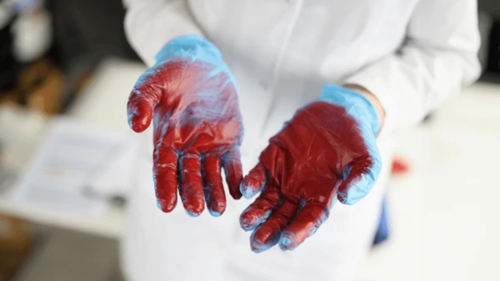 new-controversy-amid-doctors-movement-mystery-of-blood-stained-gloves