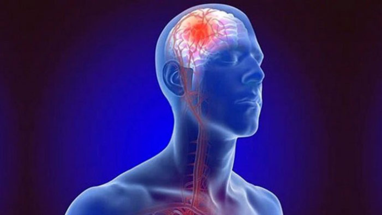 স্ট্রোকের ঝুঁকি