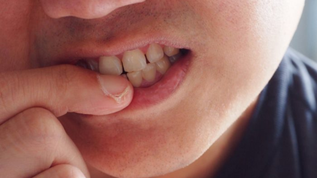 শিশুর দাঁত দিয়ে নখ কাটা