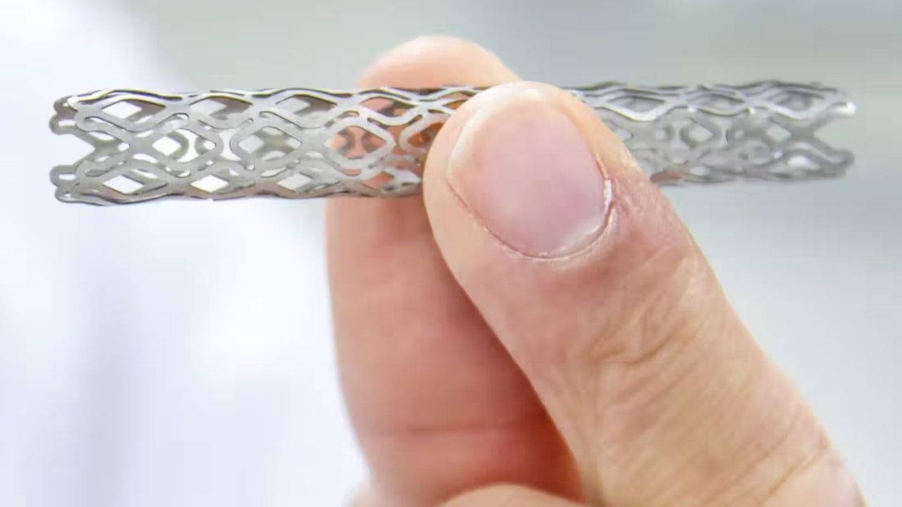 ভুলে পেটের ভেতর রেখে দেওয়া স্টেন্ট