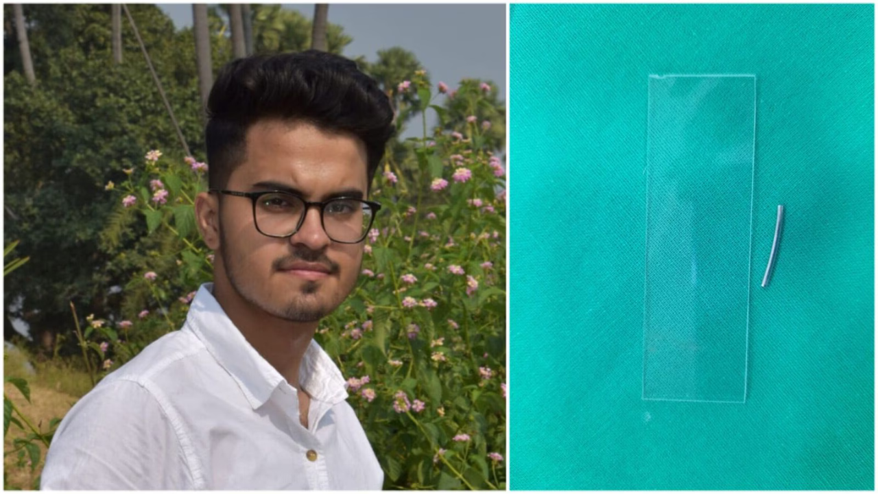 শ্বাসনালীতে আটকে গিয়েছিল ধাতব স্প্রিং