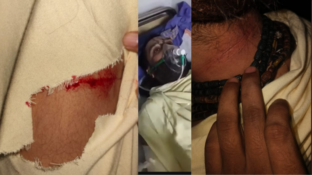 দাসপুরে সন্ন্যাসীর ওপর হামলা শুভেন্দু অধিকারীর তীব্র নিন্দা