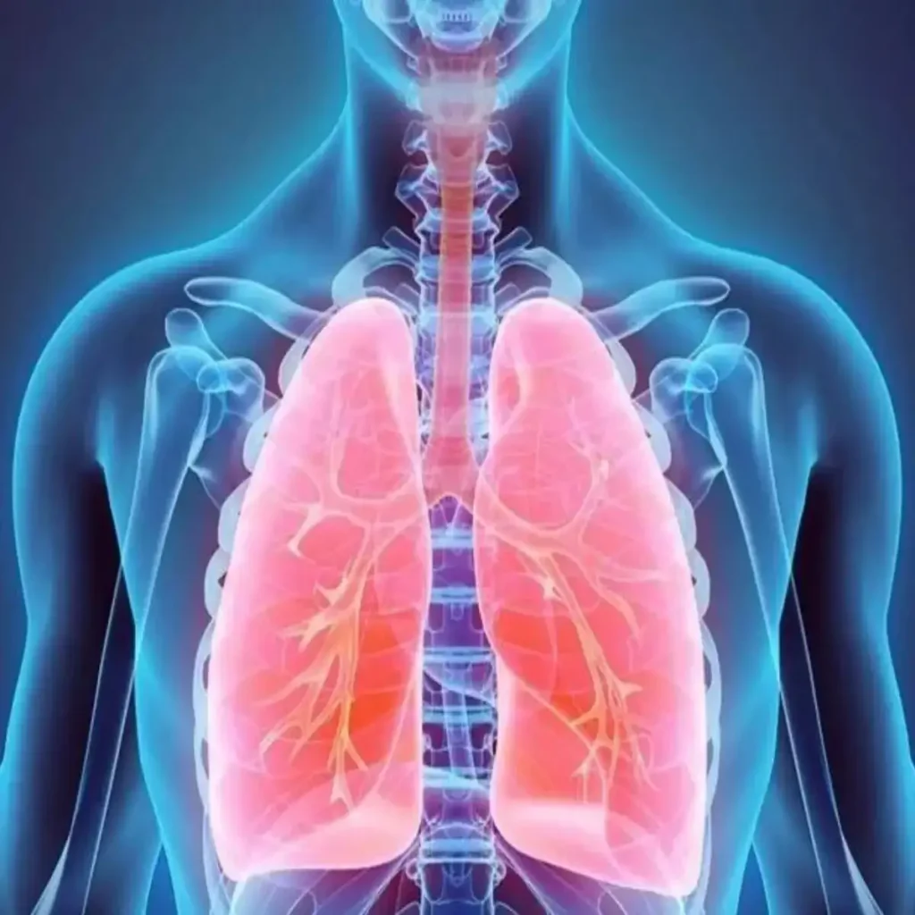Chronic lung issues rising in young adults, reveals Delhi scan data