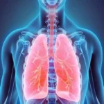 Chronic lung issues rising in young adults, reveals Delhi scan data