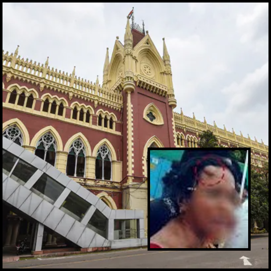 calcutta hc orders probe into rgkar victim's police brutality
