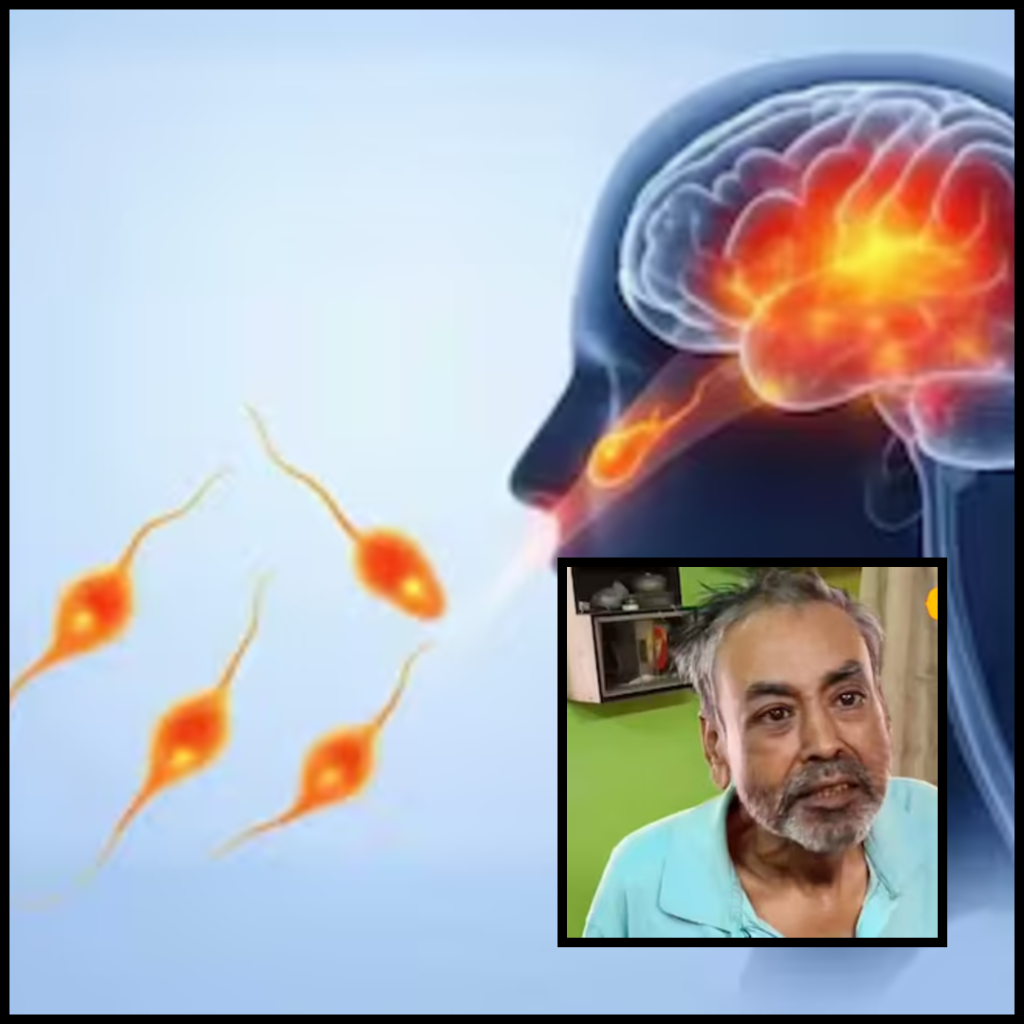 amoebic meningoencephalitis sreerampur