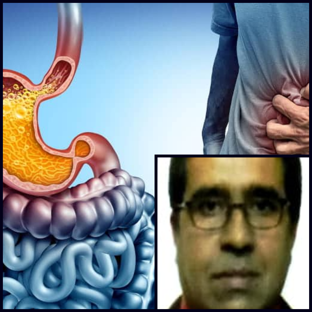 acidity symptoms and remedy doctor Santanu Ganguly