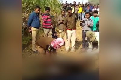 purba-medinipur-burn-case.jpg